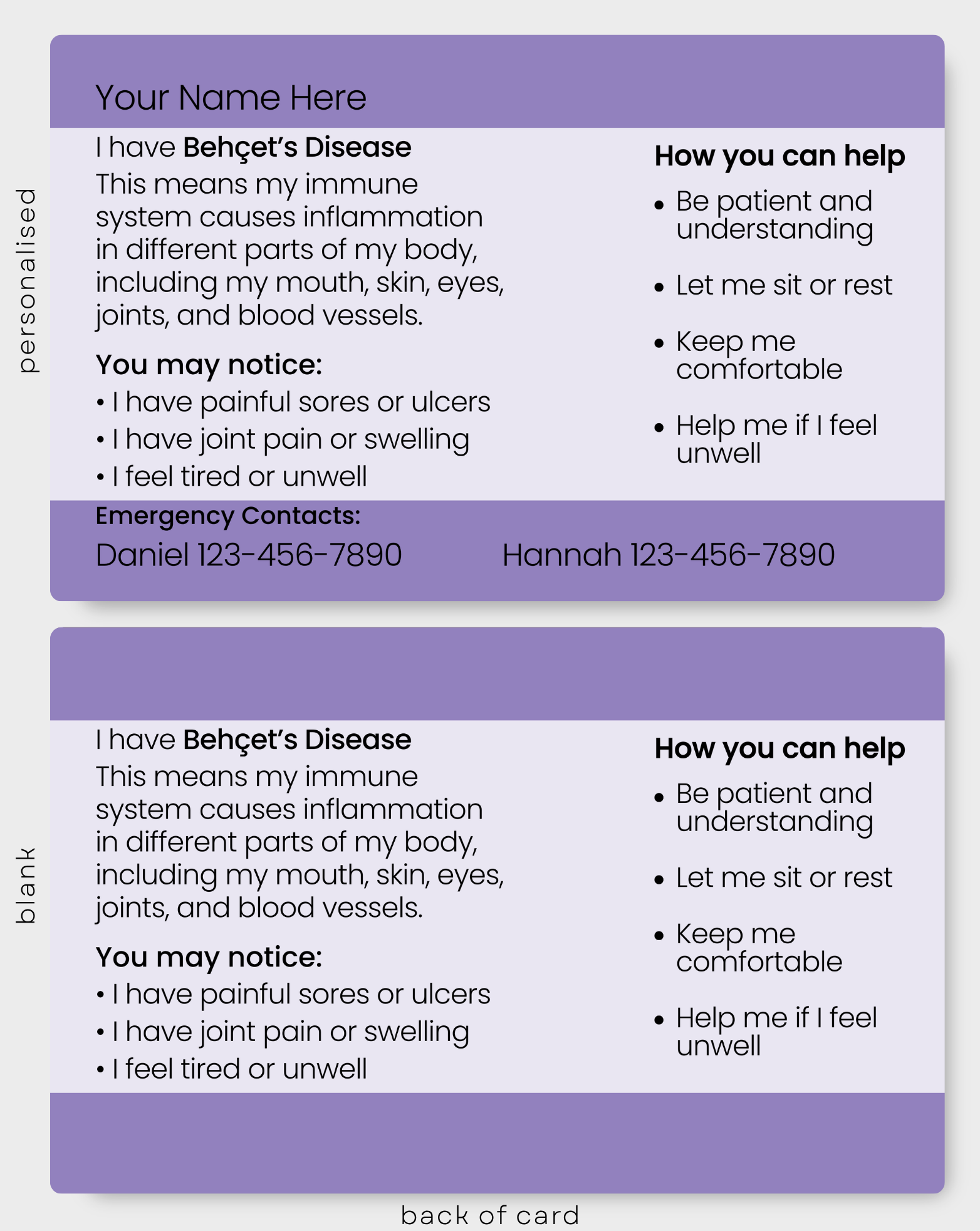 Behçet’s Disease