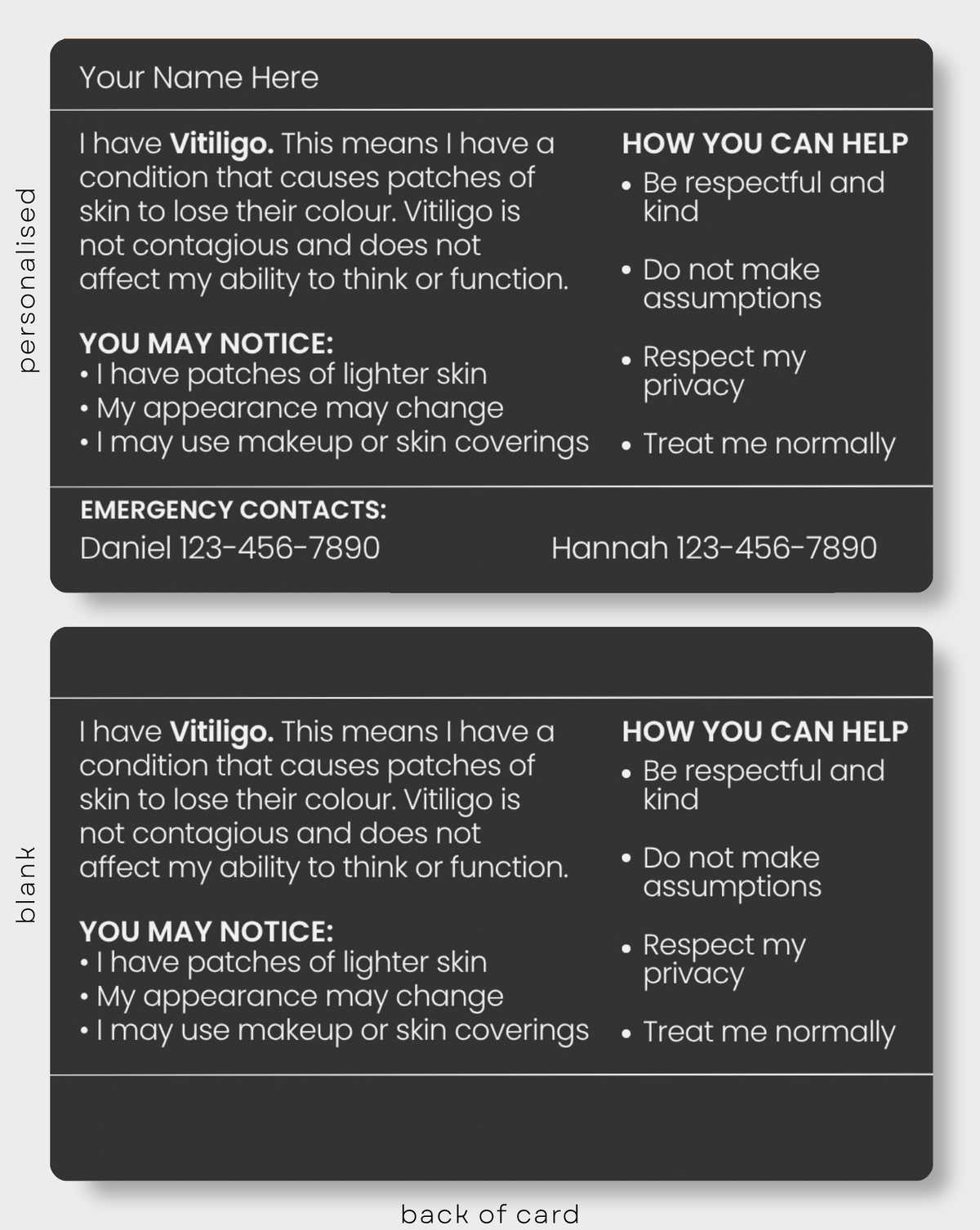 Vitiligo