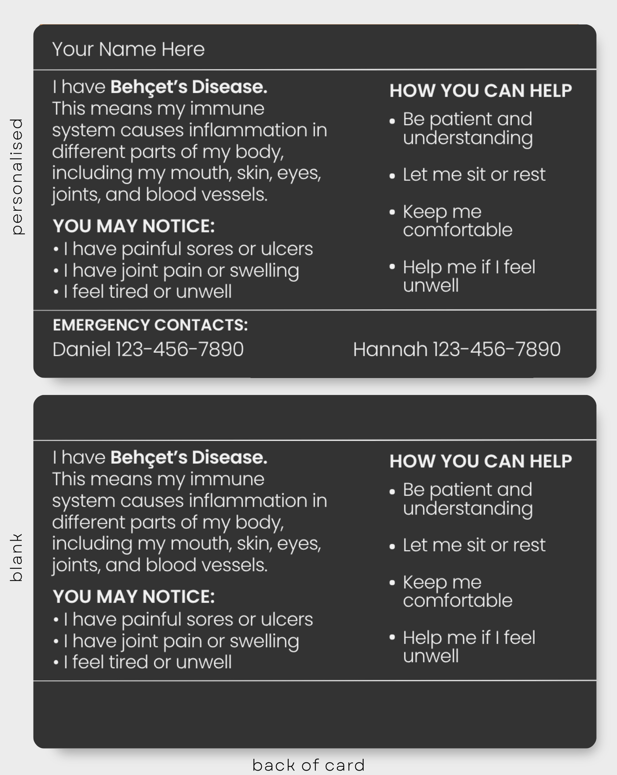 Behçet’s Disease